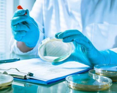EN 1657: Quantitative Suspension Test To Evaluate Fungicidal And Yeasticidal Activity Of Disinfectants