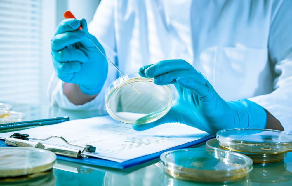 EN 1657: Quantitative Suspension Test To Evaluate Fungicidal And Yeasticidal Activity Of Disinfectants