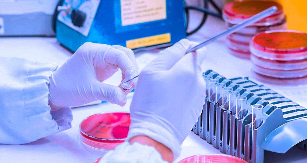 EN 14476: Ensayo Virucida Para Antisépticos Y Desinfectantes