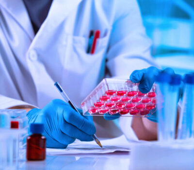 EN 1275: Quantitative Suspension Test For Fungicidal And Yeasticidal Activity