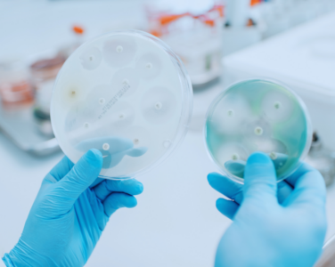 Challenge Test ISO 11930 En Cosméticos: Cómo Evaluar La Protección Antimicrobiana