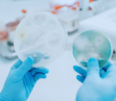 ISO 11930 Challenge Test for cosmetic products