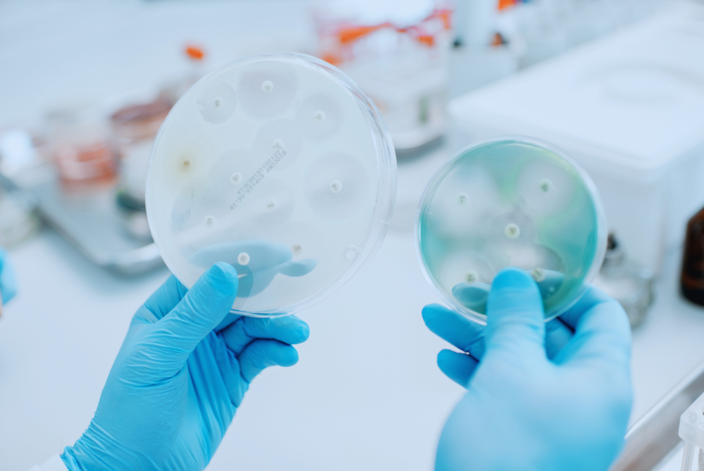 Challenge Test ISO 11930 En Cosméticos: Cómo Evaluar La Protección Antimicrobiana